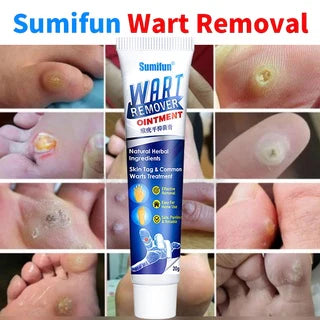 Warts Remover Cream Extract Skin