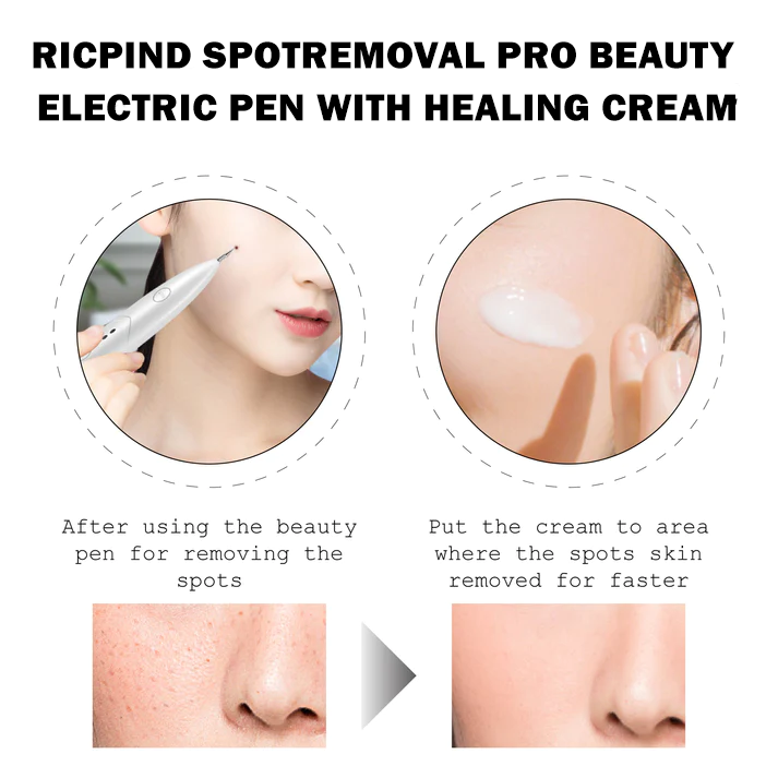 RICPIND SpotRemoval Pro Beauty Electric Pen