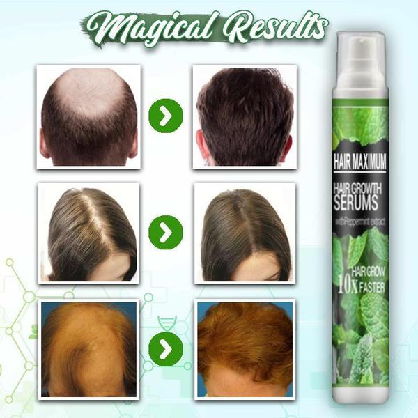 Herbal Hair-Growth Essence Spray【INCOD + Local Stock (Express 3 Day Delivery)】