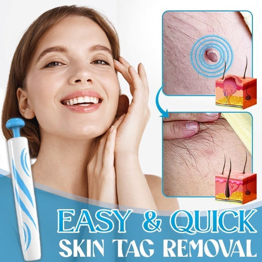 Auto-Micro Skin Tag Remover【Maha Shivaratri/Holi Offer-40%】