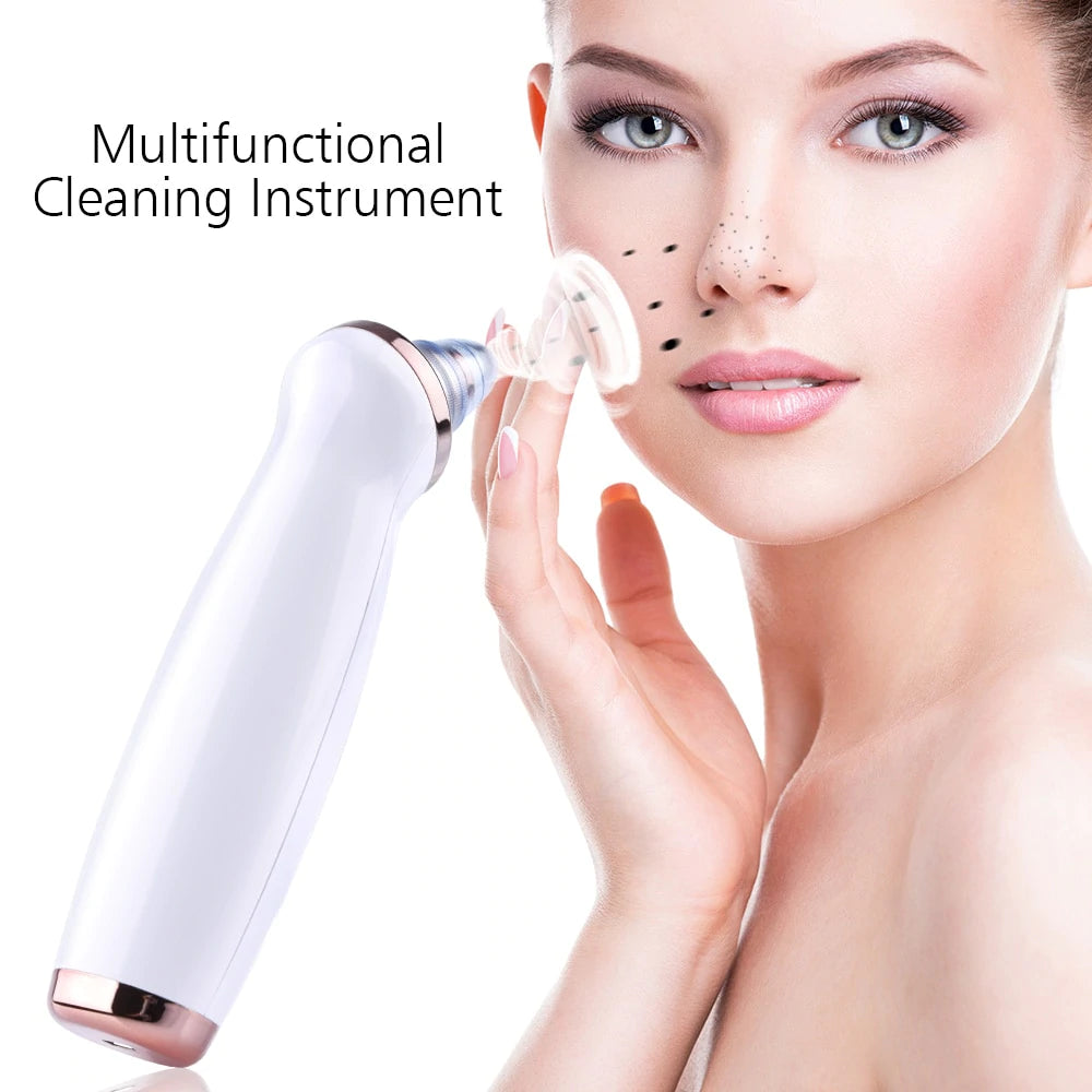 MyFace™ - Blackhead Remover【3 Day Delivery&Cash on delivery-HOT SALE-45%OFF🔥】