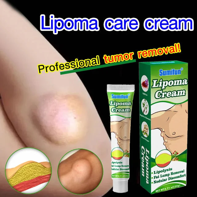 Lipoma Care Cream