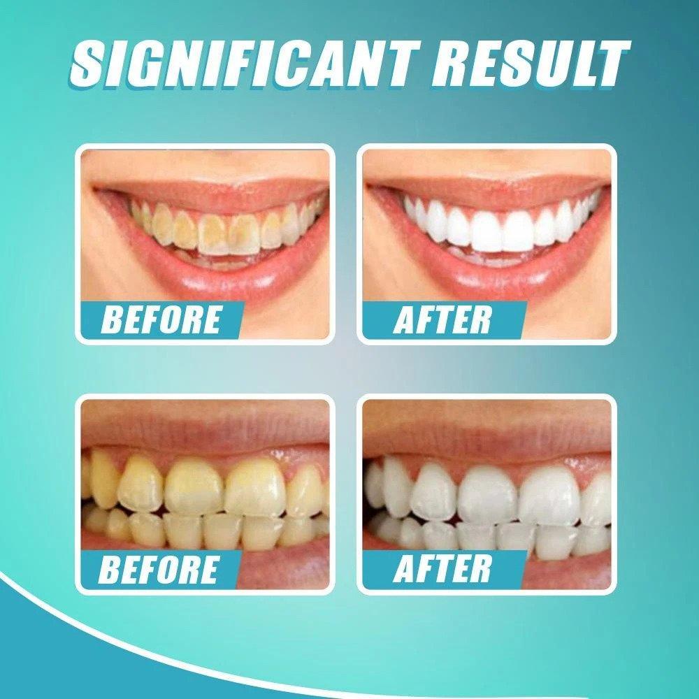 Intensive Stain Removal Whitening Toothpaste【🚚CASH ON DELIVERY + LOCAL STOCK (EXPRESS 3 DAY DELIVERY)】 TO2
